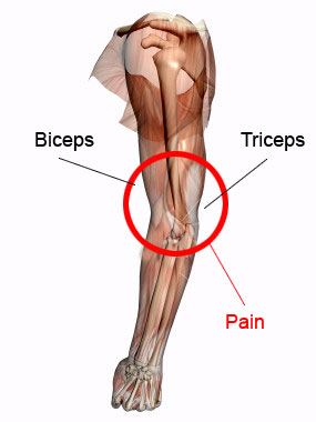 Pain Triceps Biceps Pitching