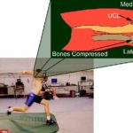 Biomechanics of Elbow Injuries During Throwing