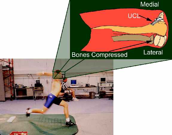 How to Speed Rest Recovery Pitching in a Baseball Game