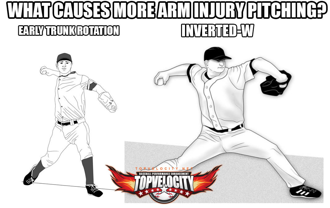 Study: Early Trunk Rotation More a Risk of Pitching Injury than Inverted-W