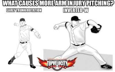 Study: Early Trunk Rotation More a Risk of Pitching Injury than Inverted-W