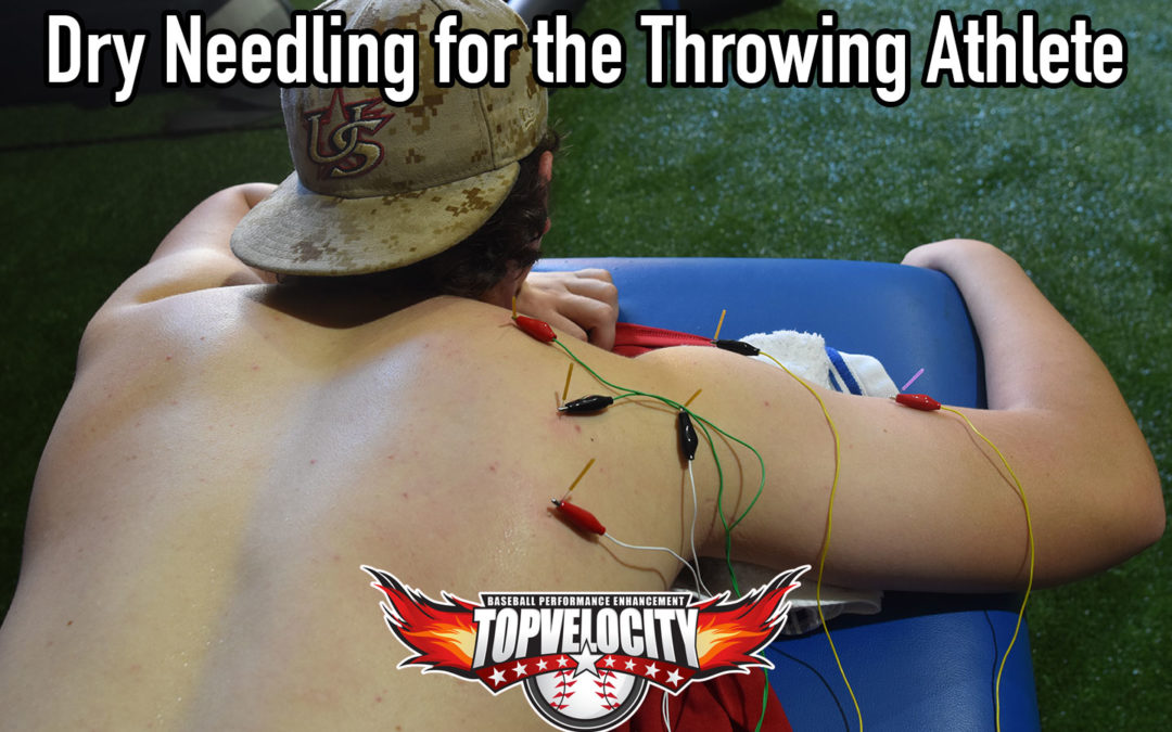 Dry Needling for The Throwing Athlete