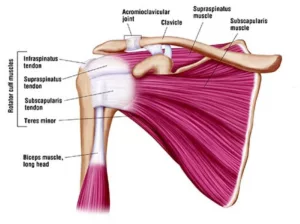 torn rotator cuff